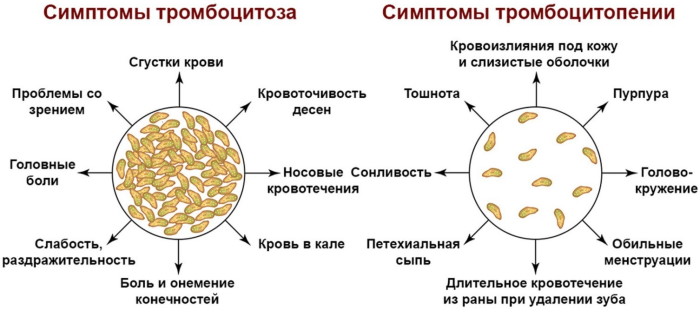 Тромбоциты по Фонио. Норма, что это, как сдать