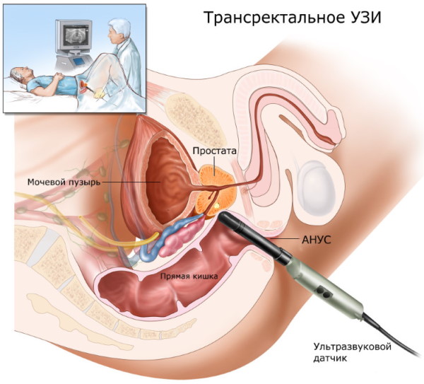 УЗИ матки и придатков. Как делают, подготовка, на какой день цикла