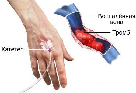 Фото как на руке режут вены