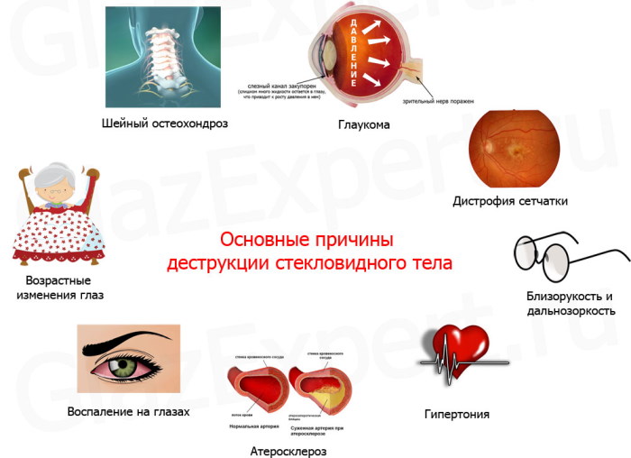 Око-Плюс капли для глаз. Инструкция по применению, цена, отзывы