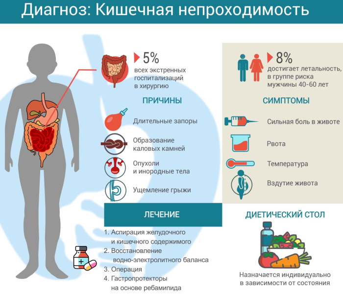 Кишечная непроходимость у детей. Симптомы, клинические рекомендации