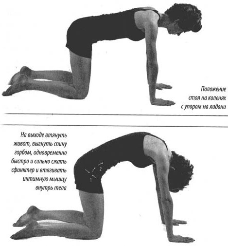 Лордоз и кифоз позвоночника. Что это, фото, лечение, упражнения