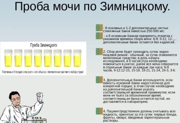 Моча по Зимницкому. Как собрать правильно, алгоритм