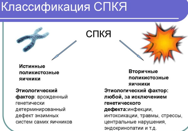 Поликистоз яичников. Симптомы и причины возникновения