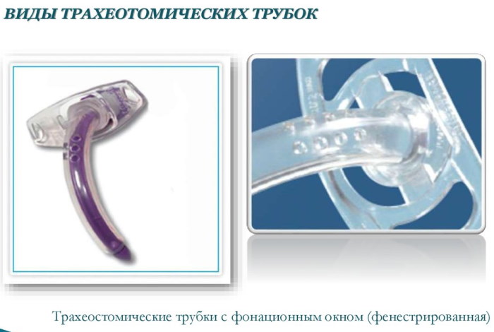 Трахеостомия: набор инструментов, техника выполнения, виды