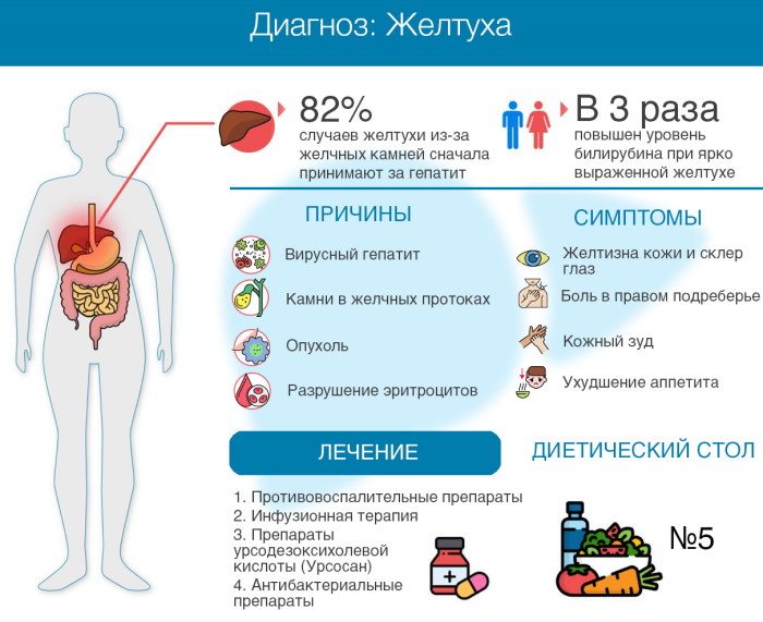 Желтуха у взрослых. Причины, симптомы, лечение, последствия