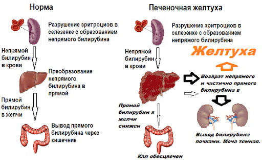 Желтуха у взрослых. Причины, симптомы, лечение, последствия