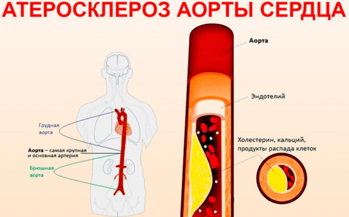 Митральная конфигурация сердца. Рентгенограмма, что это, характеристика