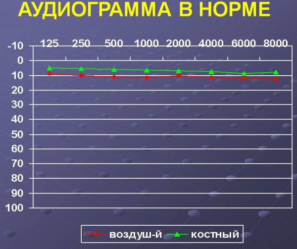 Аудиограмма слуха. Расшифровка, таблица, норма