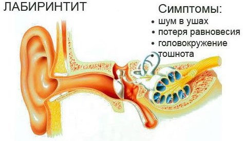 Головокружение и шум в ушах. Причины у женщин, мужчин