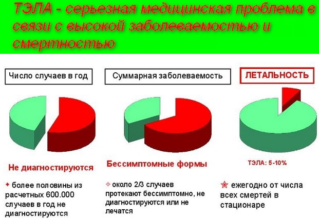 ТЭЛА на ЭКГ. Признаки, фото, что это, лечение