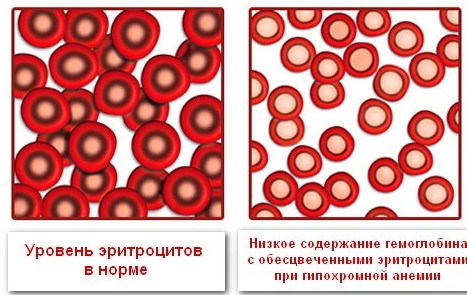 Цветовой показатель крови. Норма у женщин, детей, мужчин по возрасту