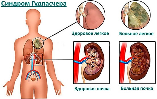 Цветовой показатель крови. Норма у женщин, детей, мужчин по возрасту