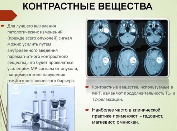 Фистулография свища. Что это такое, как проводится