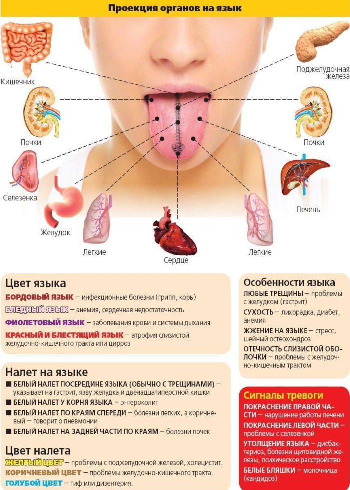 Как по языку определить заболевание: цвет, схема, симптомы