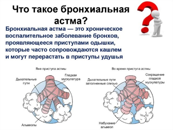 Ксенонотерапия. Что это такое, цена лечения, отзывы