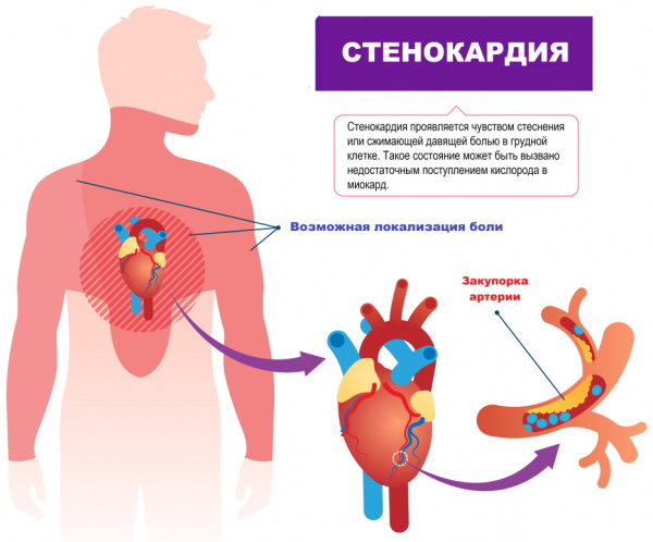 Ксенонотерапия. Что это такое, цена лечения, отзывы