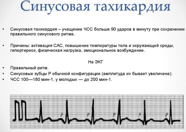 Солнечное сплетение схема