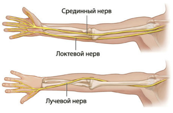 Нейропатия. Что это такое, симптомы, как лечить