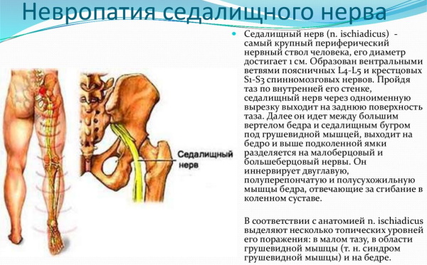 Нейропатия. Что это такое, симптомы, как лечить