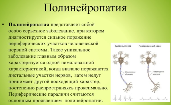 Нейропатия. Что это такое, симптомы, как лечить