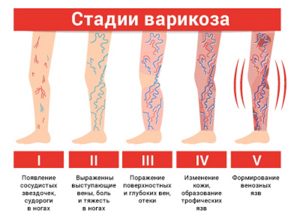 Субкомпенсация на резидуально органическом фоне