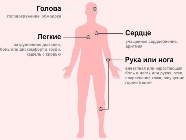 Тромб в сердце. Симптомы, лечение, что делать, причины