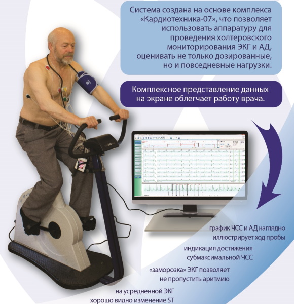 ВЭМ обследование. Что это такое, велоэргометрия сердца, расшифровка