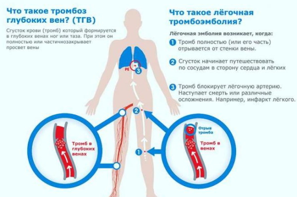 Диеногест. Что это, препараты, инструкция, цена