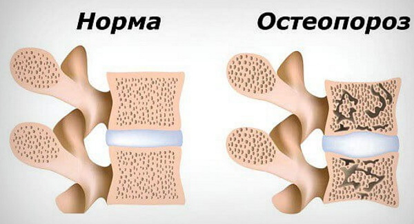 Эластография щитовидной железы. Что это такое, УЗИ, отзывы