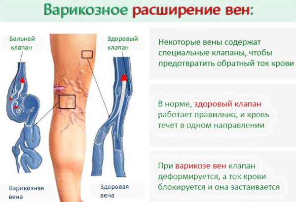 Фомидан плюс. Инструкция по применению, цена, отзывы