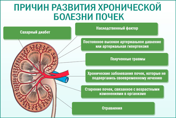 Хроническая почечная недостаточность. Симптомы, лечение, стадии