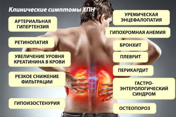 Тестостерон пропионат (Testosterone propionate). Инструкция по применению