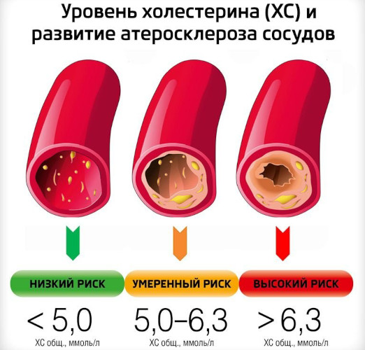 Крестор или Розувастатин. Что лучше, советы, отзывы