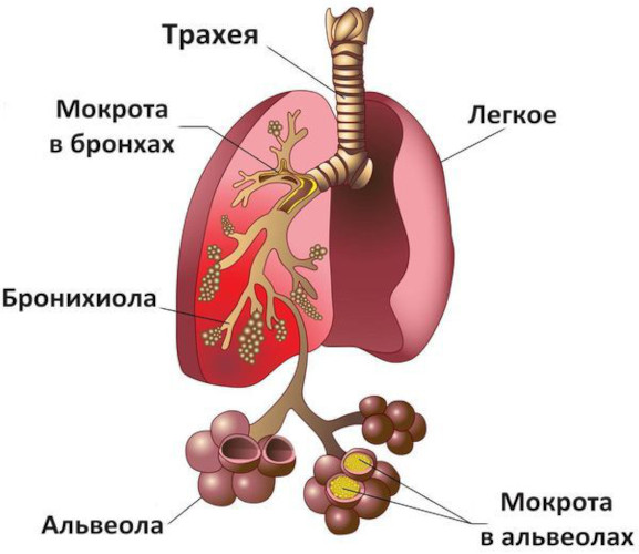 Левопронт сироп. Инструкция по применению, цена, отзывы