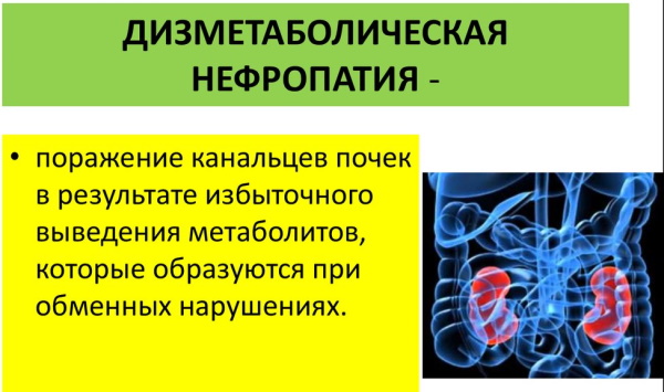 Нефропатия почек. Что это такое, симптомы и лечение у детей