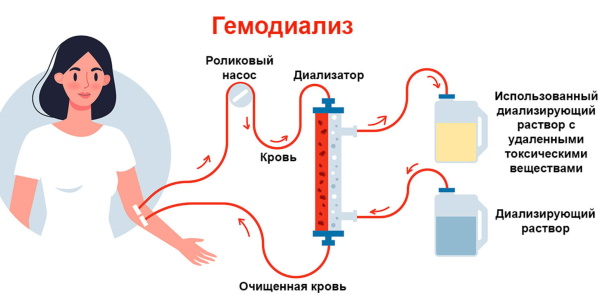 Поликистоз почек на УЗИ. Что это, симптомы и лечение