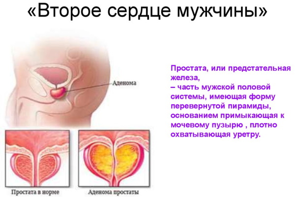 Простата. Анатомия, строение, МРТ, УЗИ