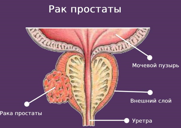 Простата. Анатомия, строение, МРТ, УЗИ