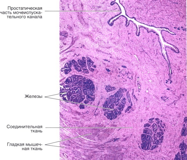 Простата. Анатомия, строение, МРТ, УЗИ