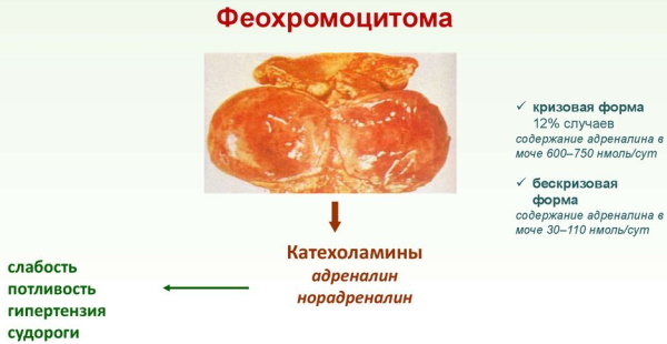 Тестостерон понижен у женщин. Причины, последствия