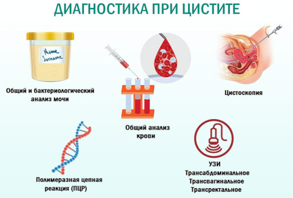 Цистит после месячных. Причины, может ли быть задержка