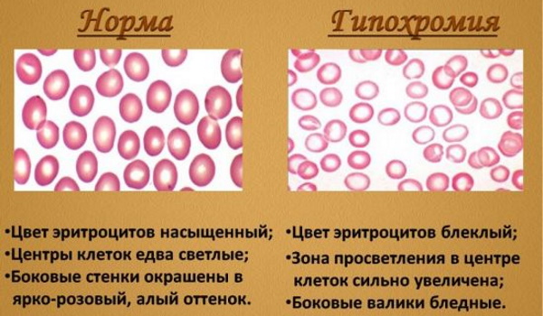 Цветовой показатель крови понижен у взрослого, женщины, ребенка