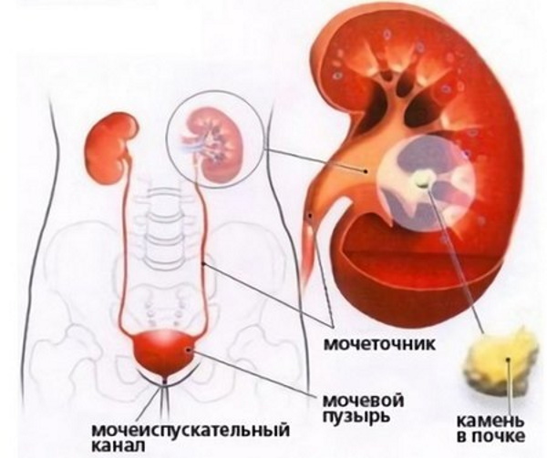 Уретроскопия. Что это у мужчин, женщин, больно ли, отзывы