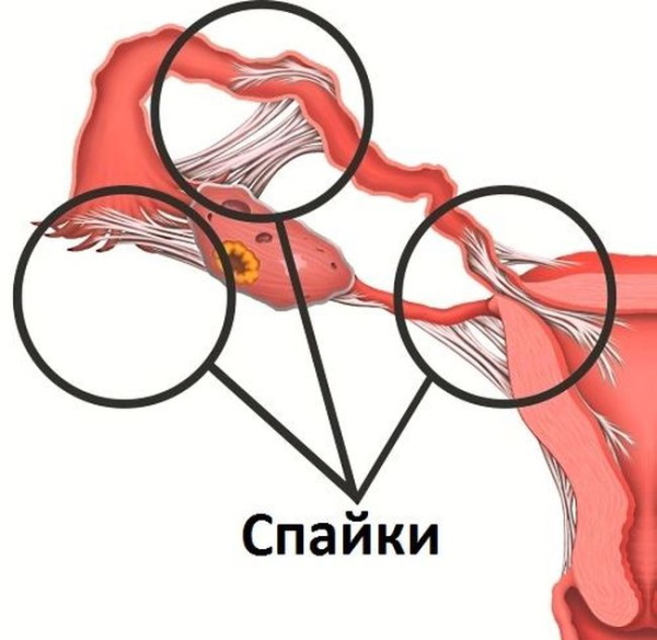 УЗИ яичников у женщин. Как проходит, что показывает