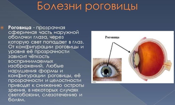 Заболевания роговицы глаза дистрофические. Лечение, рекомендации