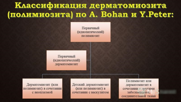 Дерматомиозит. Что это, диагностика, симптомы и лечение