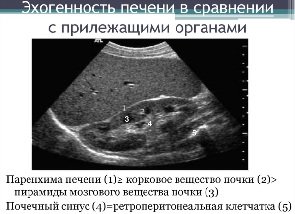 Эхогенность печени повышена. Что это значит у взрослого