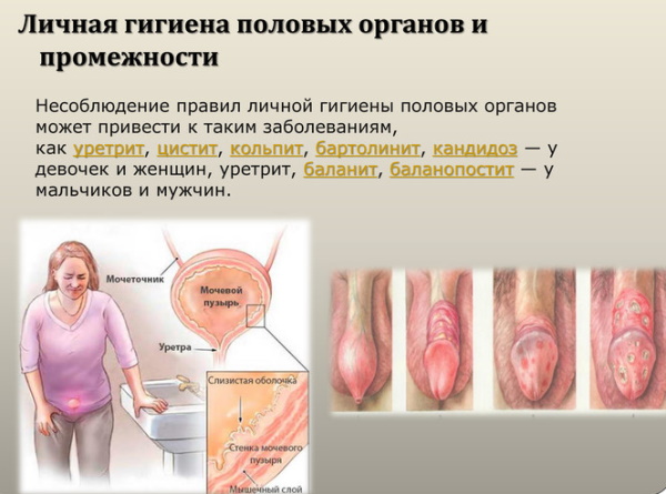 Эпителий в мазке у мужчин в большом количестве. Норма