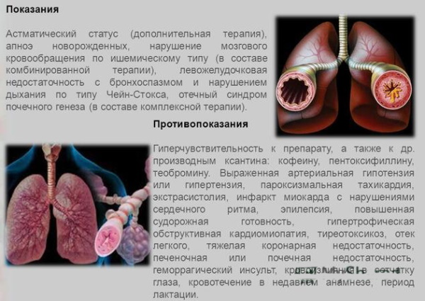 Эуфиллин капельница. Для чего назначают, инструкция